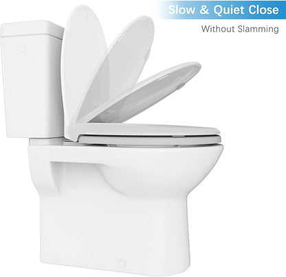 Soft Close Commercial Toilet Seat – 17 Round, Thickened White PP, Quiet Lid, Easy Install & Clean, Never Loosen, Restroom Grade, Fits Most Standard Toilets – Size: 17/19" PeacefulHues