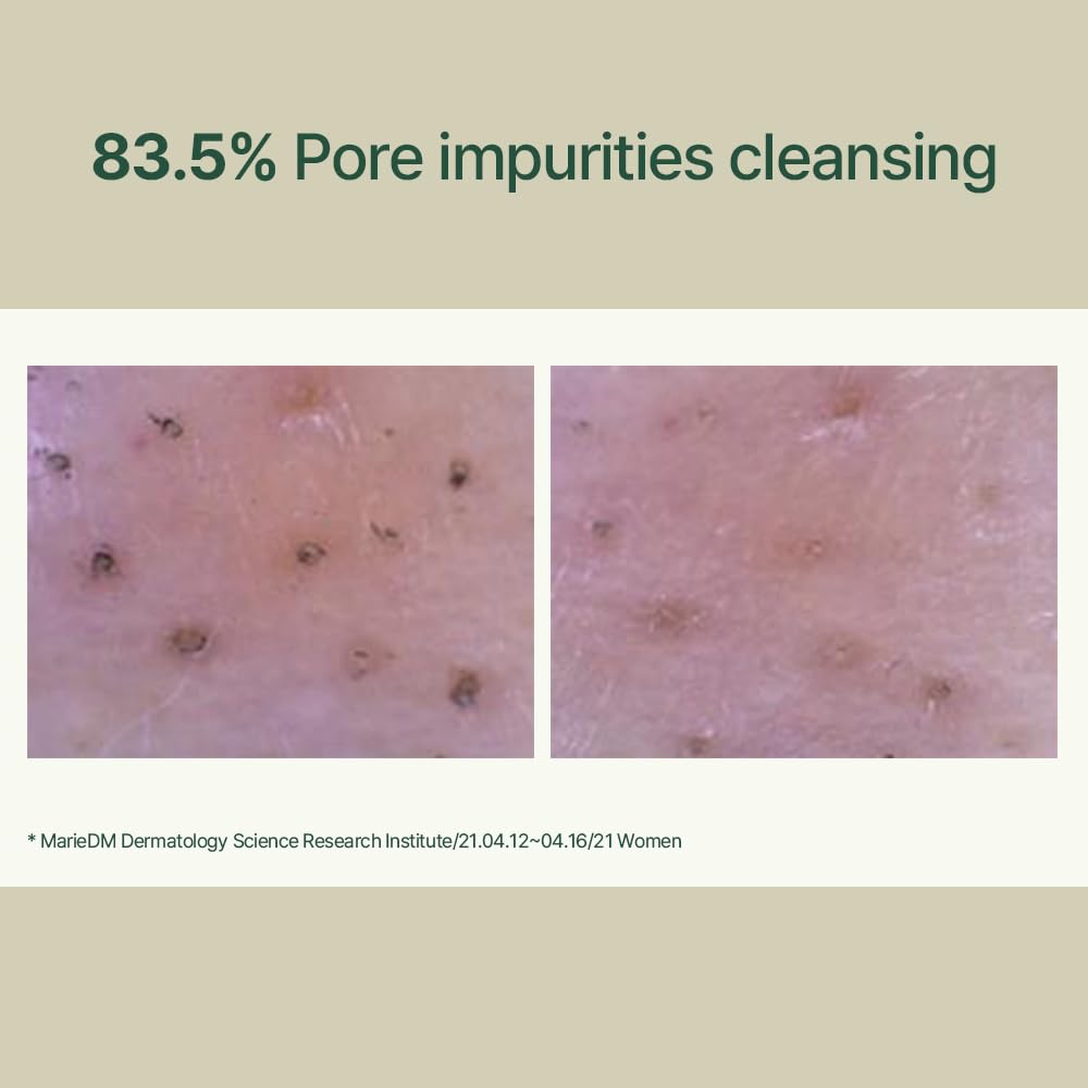 PYUNKANG YUL Calming Low pH Foaming Cleanser - Natural Centella Asiatica Moisturizing Daily Face Wash for Women and Men - Hyaluronic Facial Cleanser for Sensitive Skin - AHA Tea Tree Cica - 5.1 Fl. Oz - Available at All In One Marketplace Canada