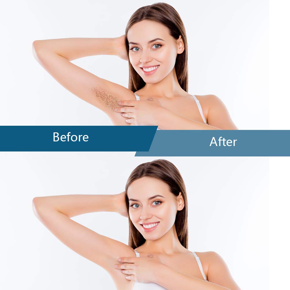 Bestidy Wax Beads, Waxing beans for Hair Removal, Women Men, Home Waxing for All Body and Brazilian Bikini Areas (Blue-1000g) - Available at All In One Marketplace Canada
