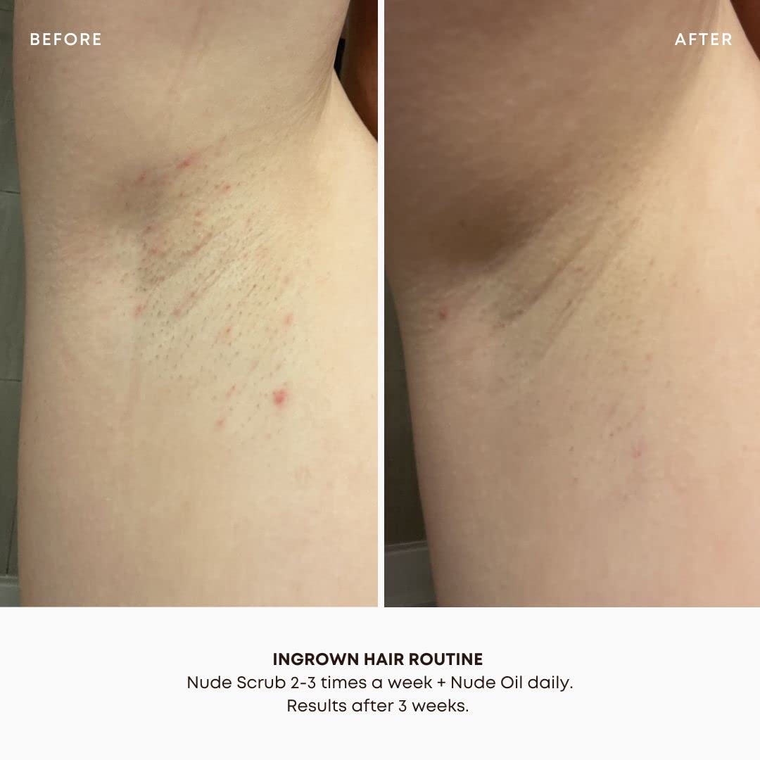 Bushbalm Ingrown Hair and Razor Bumps 2 Step Routine - Moisturize and Soothe - Nude Ingrown Hair Oil (30 ml), Nude Exfoliating Scrub (236 ml) - Nude - Valued at $49 - Available at All In One Marketplace Canada