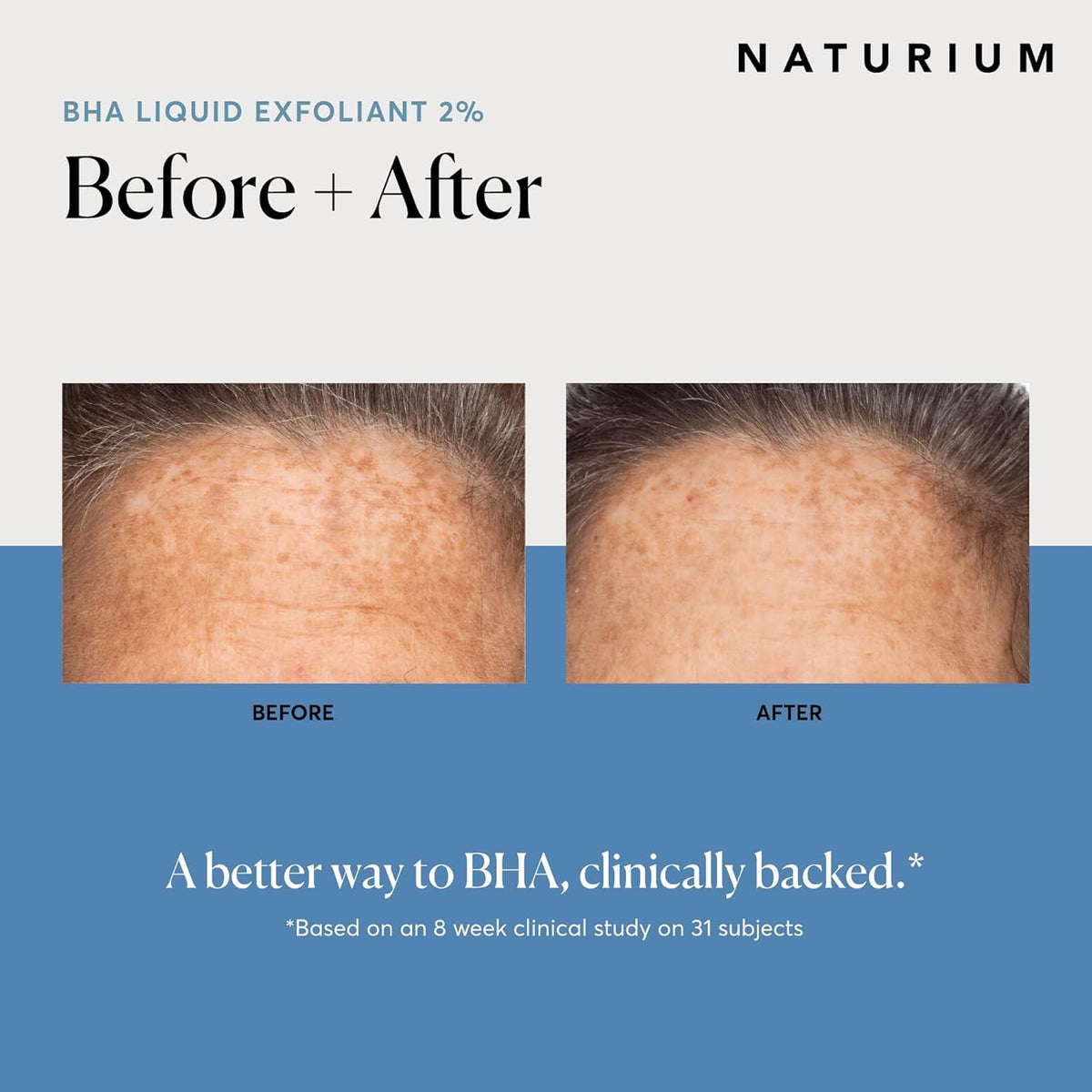Naturium BHA Liquid Exfoliant 2%, with Salicylic Acid, 120 ml / 4.0 fl oz