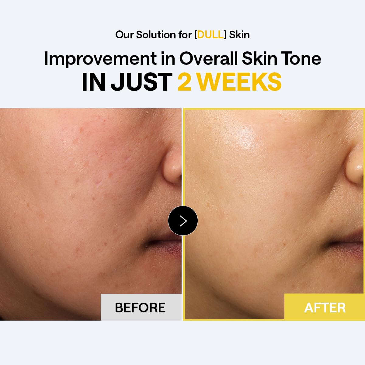 MEDIHEAL Vitamin C Brightening Toner Pads – Korean Skincare, 99% Pure Encapsulated Vitamin C with Sea Buckthorn & Glutathione, Dark Spots, Uneven Skin Tone Care, Gauze Fabric, 100 Pads