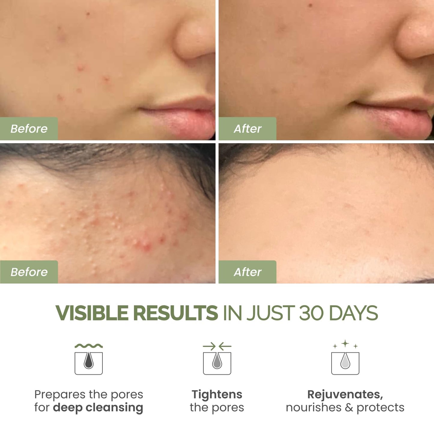PLANTIFIQUE Clay Mask with Avocado & Superfoods - Korean Face Masks Skincare Products - Dermatologically Tested - Masque Visage Beauté - Gift Idea, 110g / 3.88 fl oz - Available at All In One Marketplace Canada