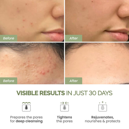 PLANTIFIQUE Clay Mask with Avocado & Superfoods - Korean Face Masks Skincare Products - Dermatologically Tested - Masque Visage Beauté - Gift Idea, 110g / 3.88 fl oz - Available at All In One Marketplace Canada
