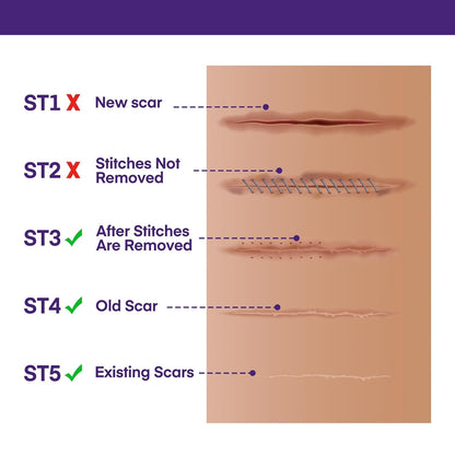 Silicone Scar Gel Scar Cream - SPF 30 Advanced Scar Gel for Old and New Scars - Available at All In One Marketplace Canada
