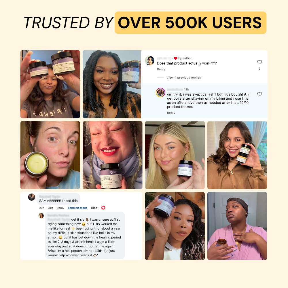 MyMagicHealer Universal Flare Care – Multi-Purpose Solution | Skin Flare-Ups - Hidradenitis Suppurativa, Folliculitis, Boils, Cysts | Anti-Chafing | Irritated Skin Relief w/Propolis & Egg Yolk 28 g - Available at All In One Marketplace Canada