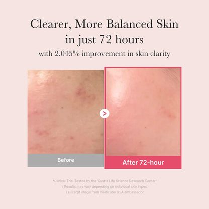 medicube TXA+Niacinamide 15% Glow Facial Serum for After Spot Care | All-in-One Daily Korean Skincare | Uneven Skin Tone, Texture, and Hydration Care | High-Potency Tranexamic Acid 5% | 1.01 fl.oz 30ml - Available at All In One Marketplace Canada
