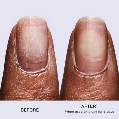 OPI Repair Mode Bond Building Nail Serum | Keratin Protein Nail Strengthening Treatment | For Stronger Nails & Nail Growth - Available at All In One Marketplace Canada