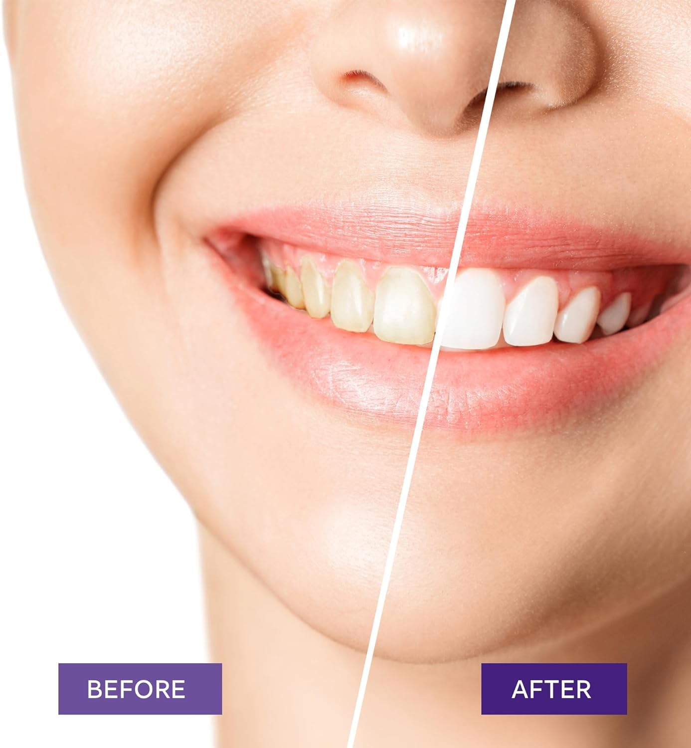 Teeth Whitening Purple Toothpaste- Toothpaste Whitening, Teeth Whitening Toothpaste, Purple Toothpaste Teeth Whitening, Tooth Whitening, Teeth Whitening Gel 30ml - Available at All In One Marketplace Canada