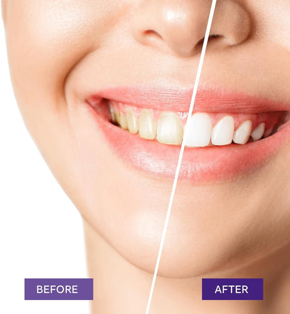 Teeth Whitening Purple Toothpaste- Toothpaste Whitening, Teeth Whitening Toothpaste, Purple Toothpaste Teeth Whitening, Tooth Whitening, Teeth Whitening Gel 30ml - Available at All In One Marketplace Canada