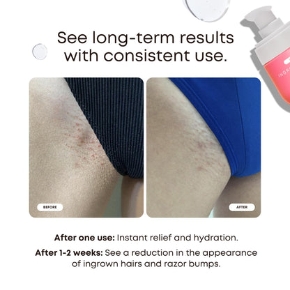 Bushbalm Ingrown Hair 2 Step Routine - Moisturize and Soothe - Ingrown Hair Oil (30 ml), Exfoliating Scrub (236 ml) - Watermelon Sugar - Valued at $49 - Available at All In One Marketplace Canada