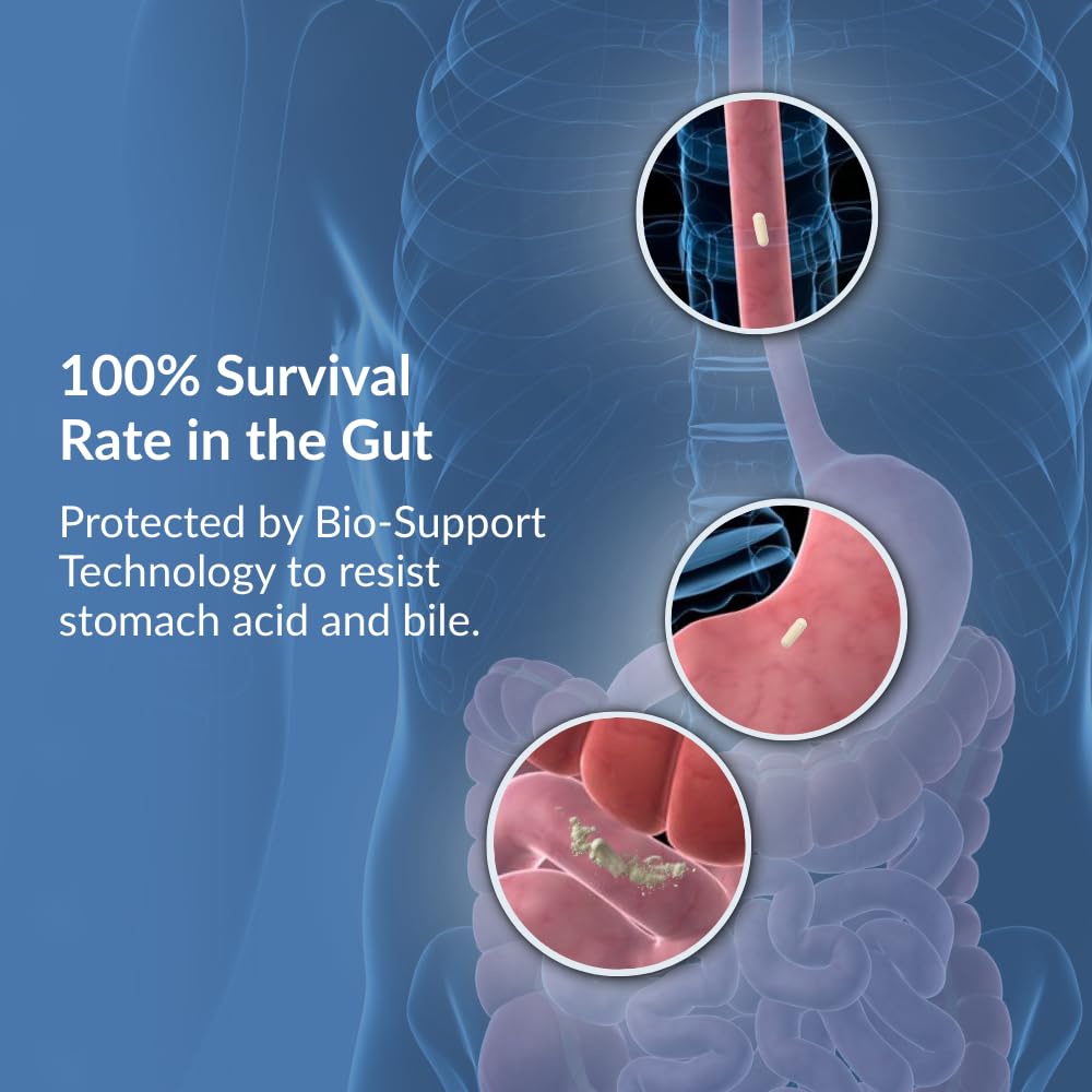Intelligent Labs 50 Billion CFU Probiotic with Prebiotics - Advanced Gut Health & Immune Support - Acid Resistant, Overfilled for Max Potency - No Refrigeration Needed - 60 Capsules (60-Day Supply) - Available at All In One Marketplace Canada