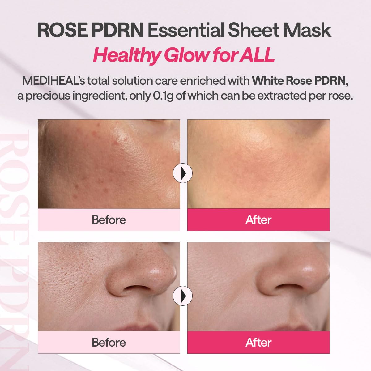MEDIHEAL Rose PDRN Essential Face Mask - Healthy Glow with Squalane & Vitamin C, Hydrating & Firming, Pore Minimizer & Moisture Barrier, Vegan, Korean Skincare for Women (10 Sheets)