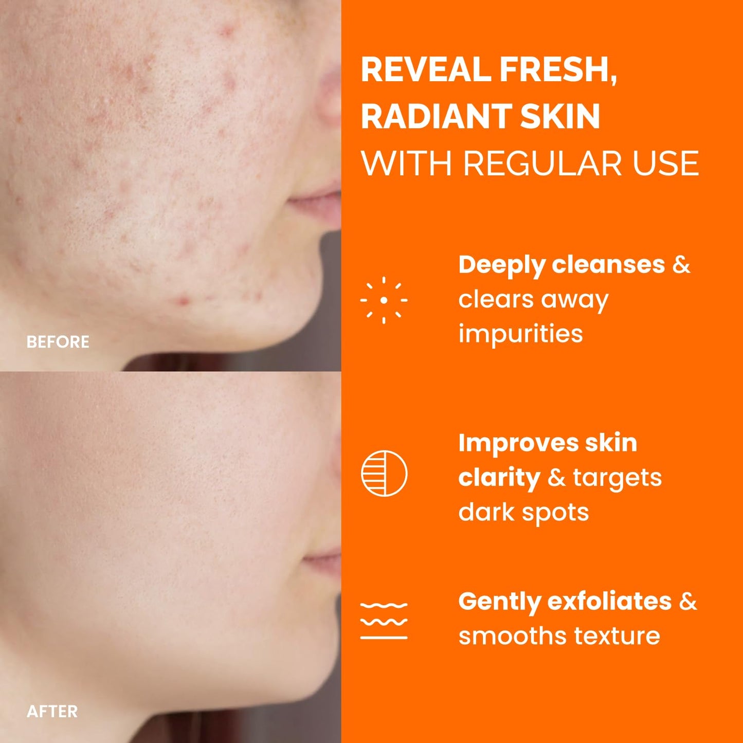 PLANTIFIQUE Kojic Acid and Turmeric Cleansing Pads - Lab-Tested - 60 Exfoliating Pads with Ceramides, Niacinamide & Vitamin C for Dark Spots & Uneven Skin Tone - Available at All In One Marketplace Canada