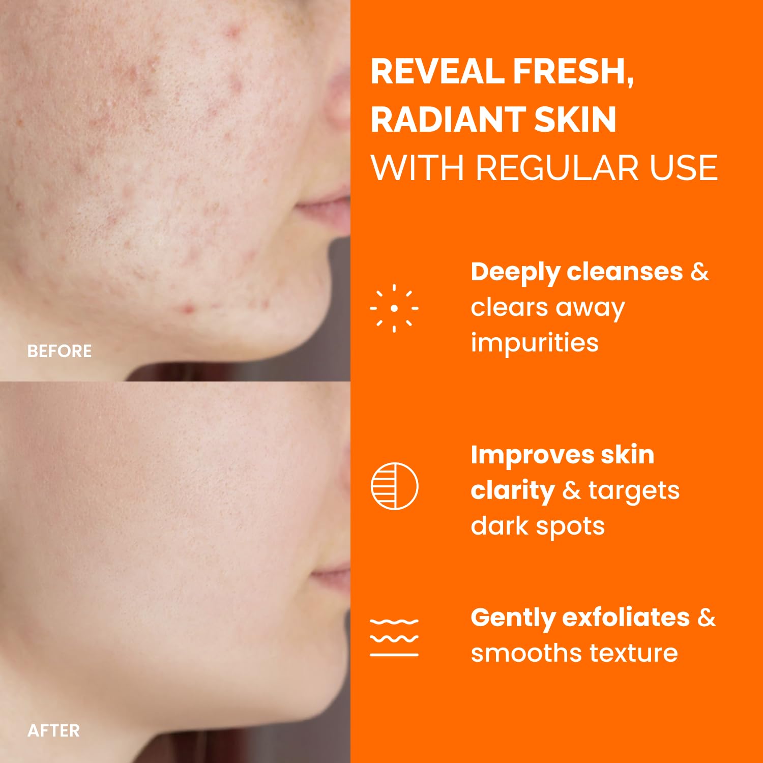 PLANTIFIQUE Kojic Acid and Turmeric Cleansing Pads - Lab-Tested - 60 Exfoliating Pads with Ceramides, Niacinamide & Vitamin C for Dark Spots & Uneven Skin Tone - Available at All In One Marketplace Canada