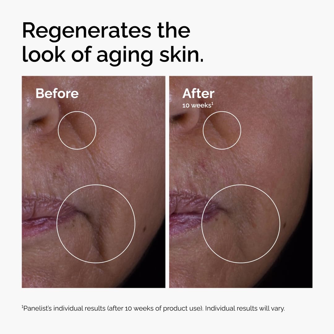 The Ordinary GF 15% Solution, Anti-Aging Formula for Visible Skin & Wrinkle Repair, 30 ml The Ordinary
