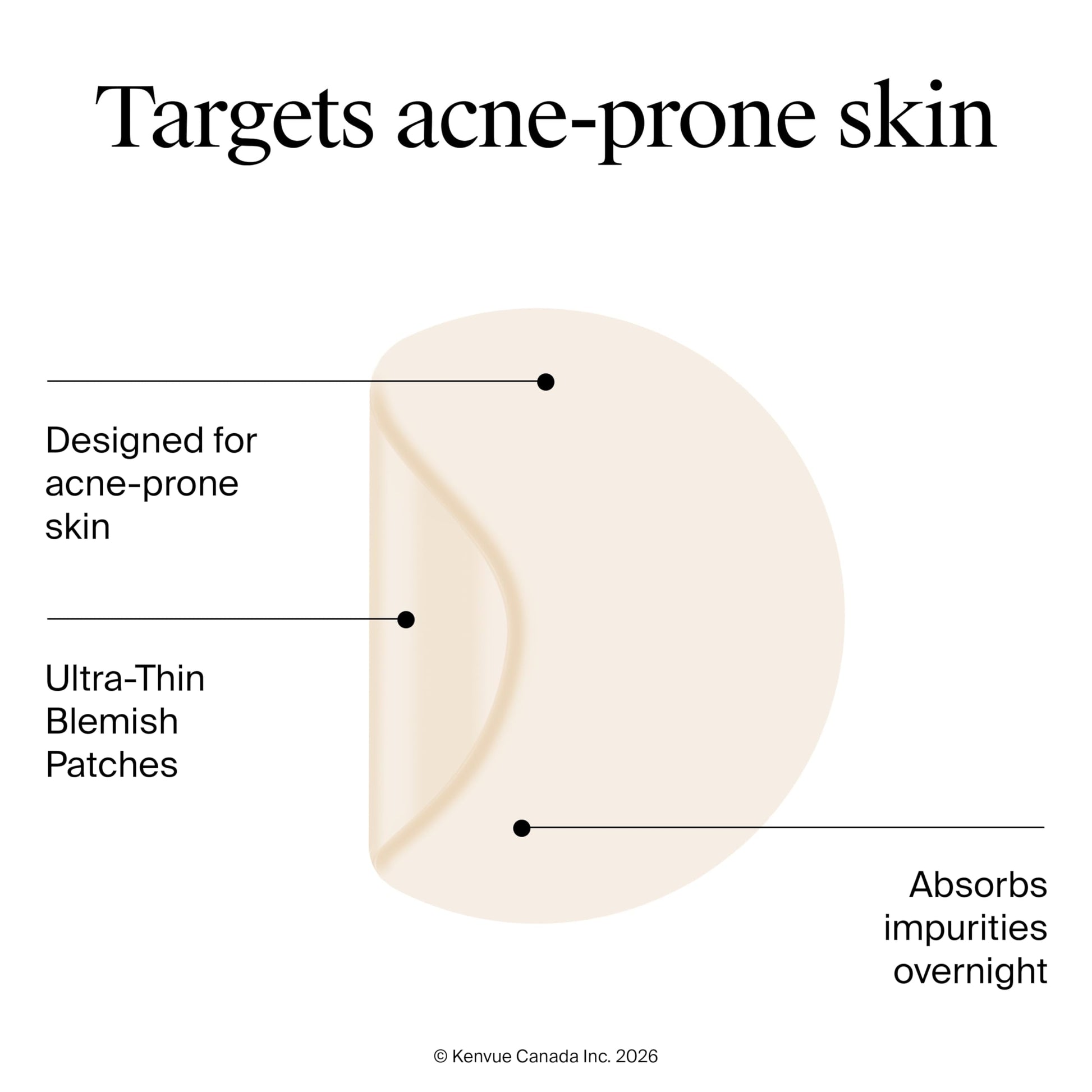 Neutrogena Stubborn Acne Blemish Pimple Patches, Hydrocolloid, 2x24 Pack Neutrogena
