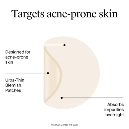 Neutrogena Stubborn Acne Blemish Pimple Patches, Hydrocolloid, 2x24 Pack Neutrogena
