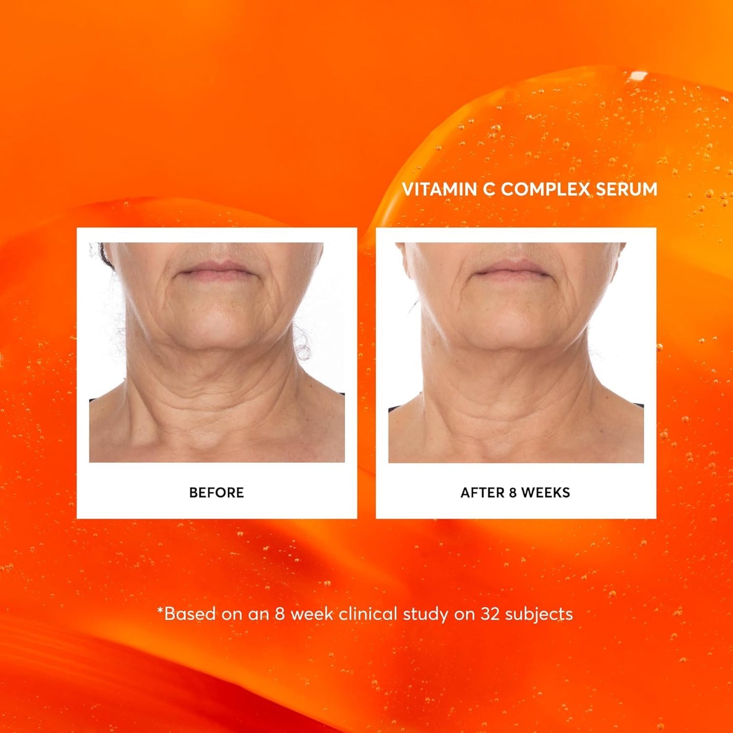 Naturium Vitamin C Complex Face Serum | With Hyaluronic Acid & Vitamin E, For Most Skin Types | 1.0 FL OZ / 30 ml - Available at All In One Marketplace Canada