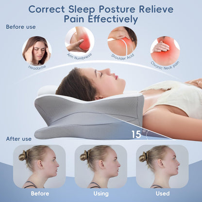 SNUGUP Ergonomic Cervical Neck Pillow, Memory Foam Neck Support Pillow with Contoured Design, Breathable Removable Pillowcase, for Side Back Stomach Sleepers, White - Available at All In One Marketplace Canada