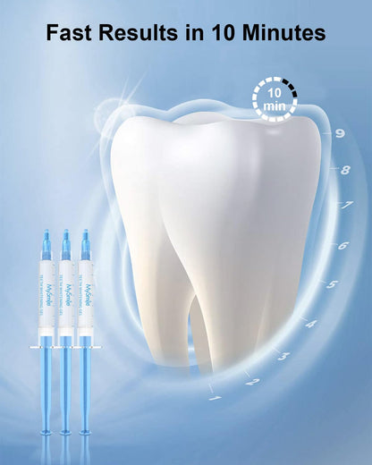 MySmile Teeth Whitening Gel Refills Pack 30+ Treatment Non-Sensitive Enamel Safe Tooth Whitener -10 Min Fast Whitening Teeth - Helps to Remove Stains from Coffee, Smoking, Wines（Excluding Tray Light） - Available at All In One Marketplace Canada