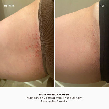 Bushbalm Ingrown Hair and Razor Bumps 2 Step Routine - Moisturize and Soothe - Nude Ingrown Hair Oil (30 ml), Nude Exfoliating Scrub (236 ml) - Nude - Valued at $49 - Available at All In One Marketplace Canada
