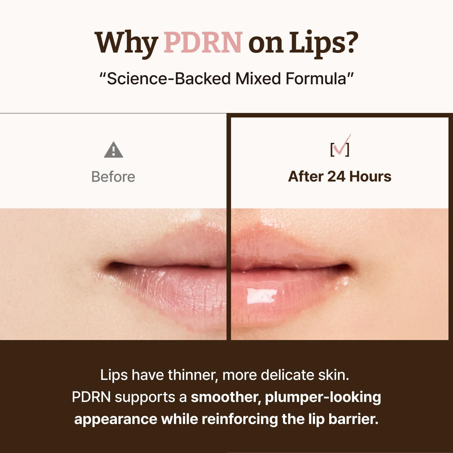 Dr. Reju-All Advanced PDRN Rejuvenating Lip Serum - Hydrating Lip Balm with Lipozip PDRN for Glowy, Dewy Lips - Gentle Exfoliating & Smoothing Lip Moisturizer - Hibiscus & Lactic Acid - 10ml - Available at All In One Marketplace Canada