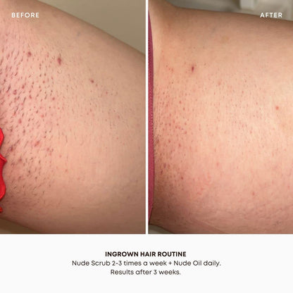 Bushbalm Ingrown Hair and Razor Bumps 2 Step Routine - Moisturize and Soothe - Nude Ingrown Hair Oil (30 ml), Nude Exfoliating Scrub (236 ml) - Nude - Valued at $49 - Available at All In One Marketplace Canada