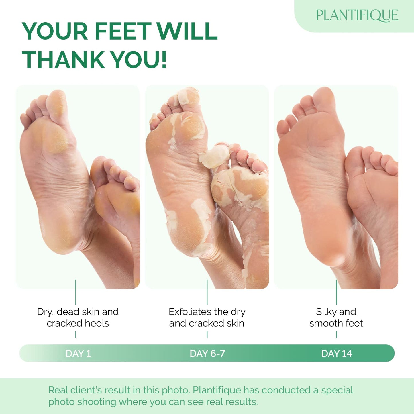 PLANTIFIQUE Foot Peel Mask Dermatologically Tested - 2 Pairs Peach Exfoliating Mask for Dry Cracked Feet - Masque Pied Peeling - Foot Care for Soft Baby Feet - Available at All In One Marketplace Canada