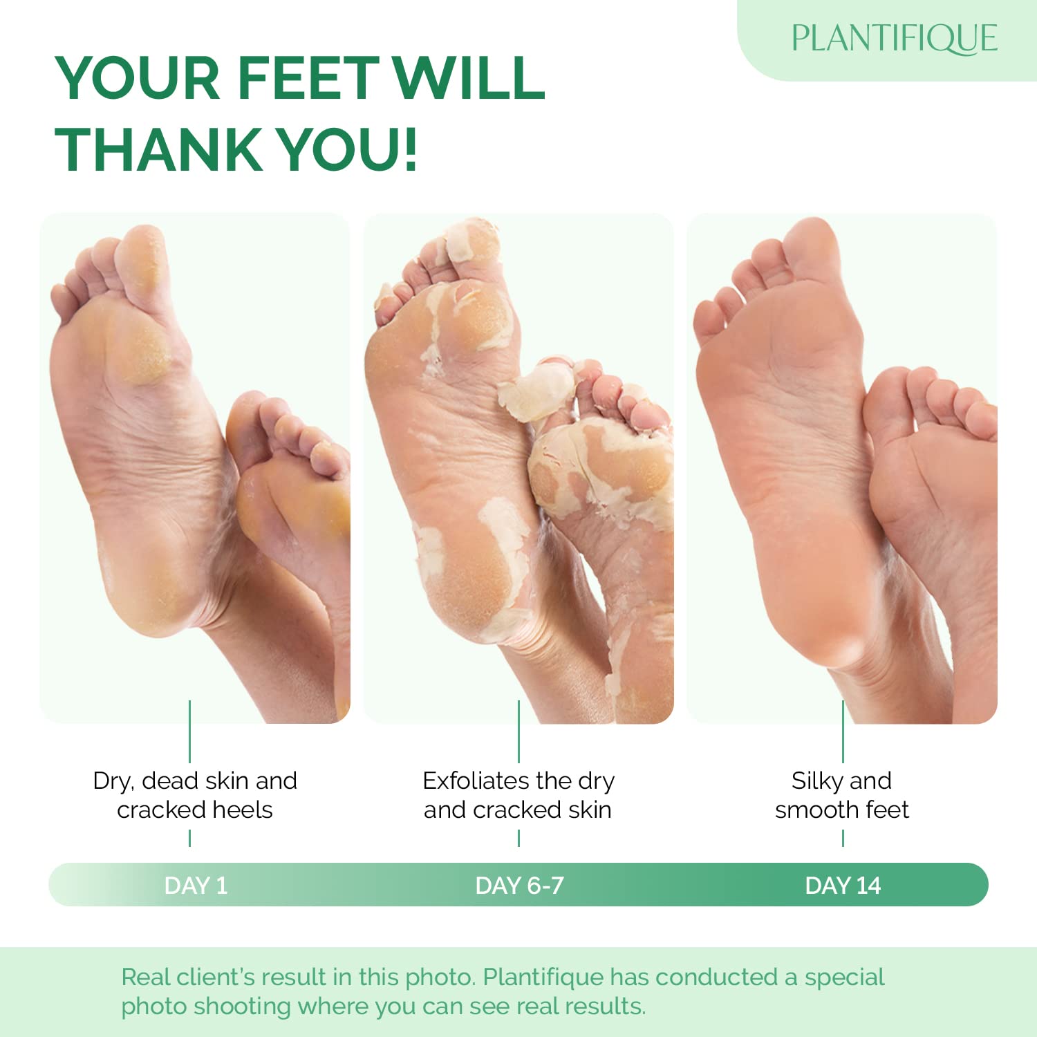 PLANTIFIQUE Foot Peel Mask Dermatologically Tested - 2 Pairs Peach Exfoliating Mask for Dry Cracked Feet - Masque Pied Peeling - Foot Care for Soft Baby Feet - Available at All In One Marketplace Canada