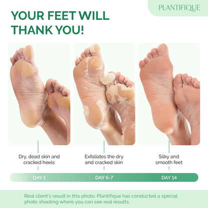 PLANTIFIQUE Foot Peel Mask Dermatologically Tested - 2 Pairs Peach Exfoliating Mask for Dry Cracked Feet - Masque Pied Peeling - Foot Care for Soft Baby Feet - Available at All In One Marketplace Canada
