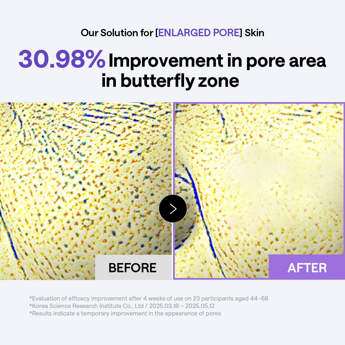 MEDIHEAL PDRN Lifting Toner Pads – Pore Tightening with Plant-Based PDRN, Peptide, Glutathione & PHA, Pore Care, Firming & Wrinkle Care, Stretchy Lifting Fabric, Korean Skin Care, 100 Pads