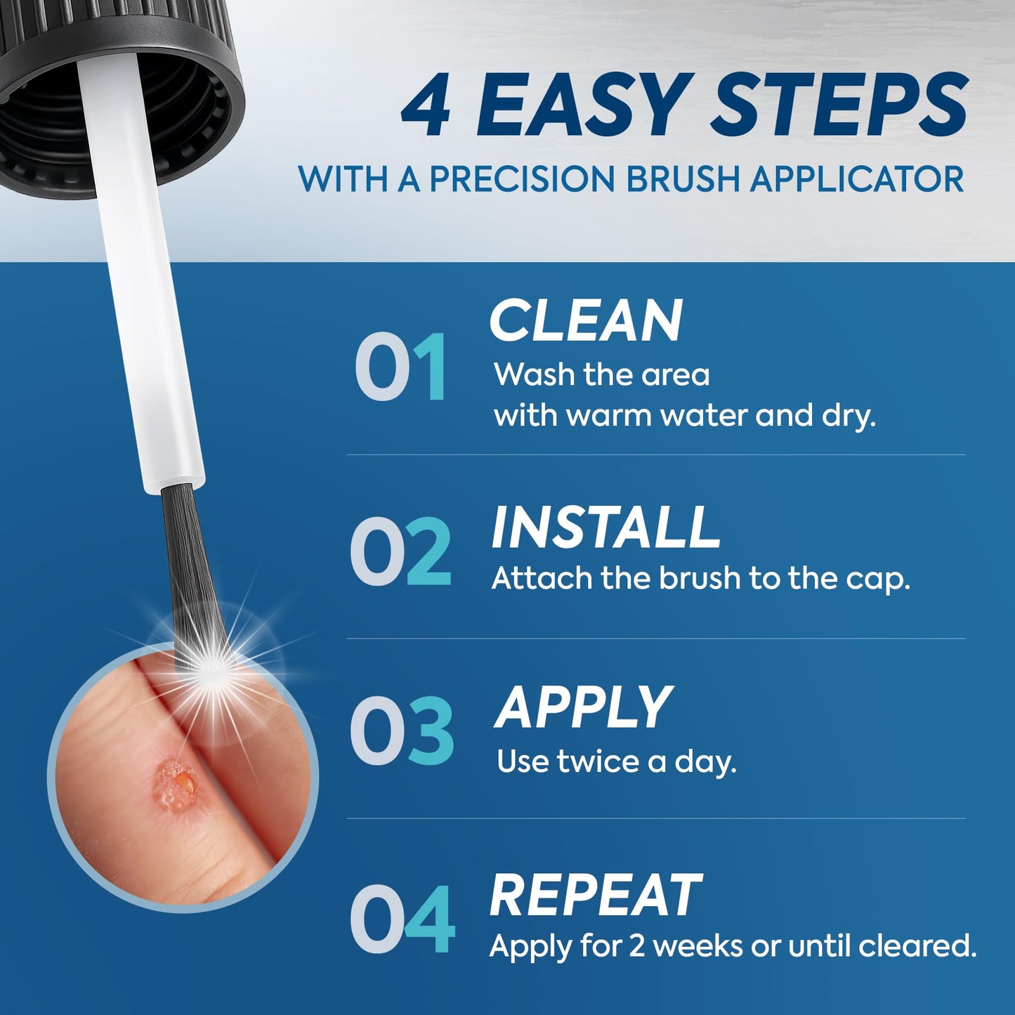 Fast-Acting Wart Corn Remover: Salicylic Acid Treatment for Feet Toe - Maximum Strength Liquid for Plantar Wart Corn Removal Men and Women - Available at All In One Marketplace Canada