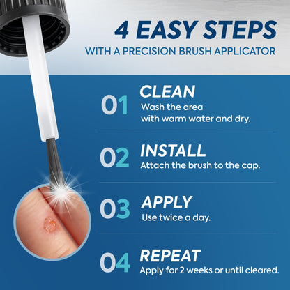 Fast-Acting Wart Corn Remover: Salicylic Acid Treatment for Feet Toe - Maximum Strength Liquid for Plantar Wart Corn Removal Men and Women - Available at All In One Marketplace Canada