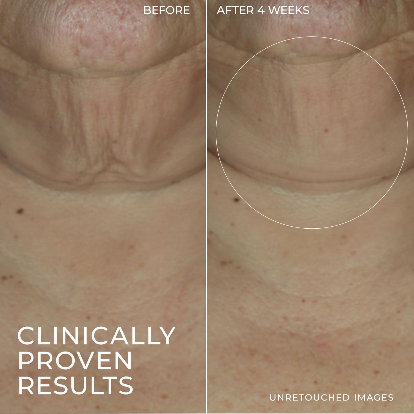 RoC Derm Correxion Firming Serum Stick 30G - Available at All In One Marketplace Canada