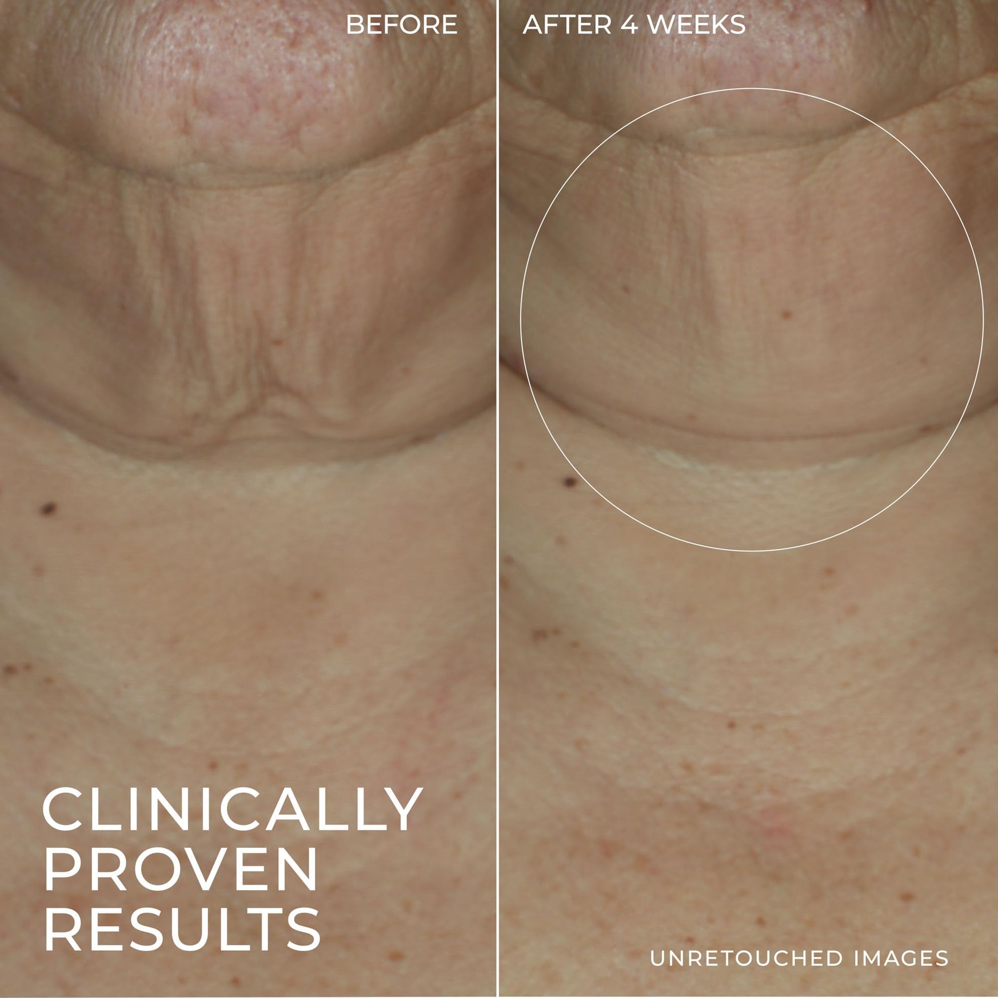 RoC Derm Correxion Firming Serum Stick 30G - Available at All In One Marketplace Canada
