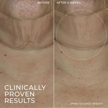 RoC Derm Correxion Firming Serum Stick 30G - Available at All In One Marketplace Canada