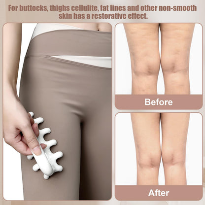 VEMOKY Fascia Massage Tool Trigger Point Massage Tools Anti Blaster for Cellulite Massager Tool Reaching Deep Myofascial Tissue Throughout The Body Release Muscle Knot Reduction Cellulite - Available at All In One Marketplace Canada
