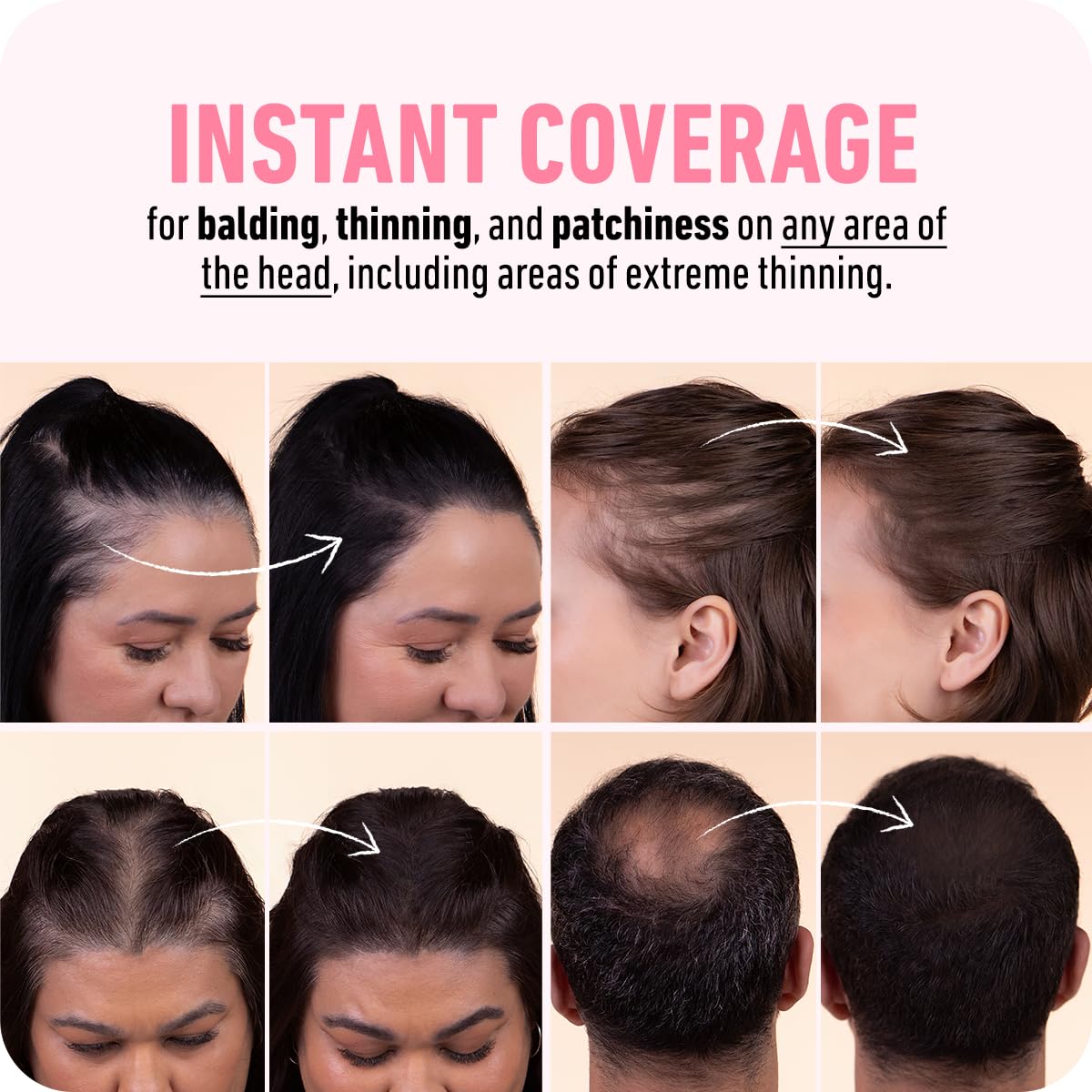 BOLDIFY Hairline Powder - Root Touch Up Hair Color for Gray Coverage - Bald Spot Concealing Hair Powder for Women & Men - 24-Hour Stain-Proof - Black