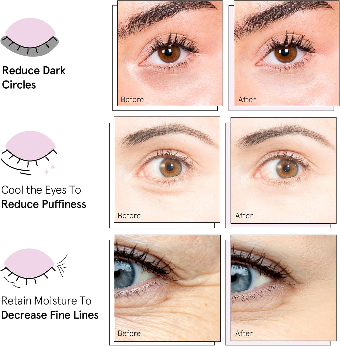 grace & stella Award Winning Under Eye Mask - Gifts for Her - Birthday Gifts for Women - Gel Eye Patches for Dark Circles, Puffy Eyes, Wrinkles, Undereye Bags - Self Care Gifts (24 Pairs, Pink)