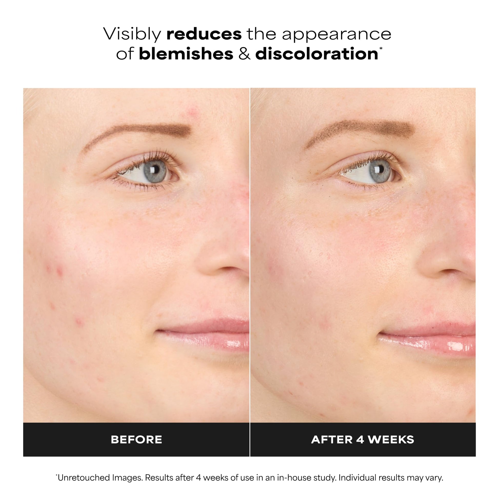 Paula's Choice BOOST 10% Azelaic Acid Booster Cream Gel, Licorice Extract & Salicylic Acid, Oil-Free Skin Serum, Fragrance-Free, 30 ml - Available at All In One Marketplace Canada