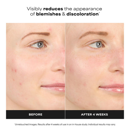 Paula's Choice BOOST 10% Azelaic Acid Booster Cream Gel, Licorice Extract & Salicylic Acid, Oil-Free Skin Serum, Fragrance-Free, 30 ml - Available at All In One Marketplace Canada