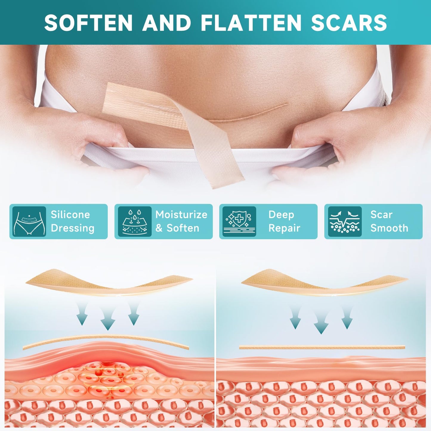Pumkot Silicone Scar Sheets, Silicone Scar Tape(1.6” x 120” Roll-3M) - Available at All In One Marketplace Canada