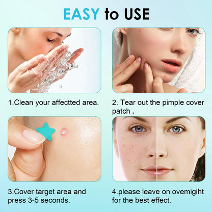 320 PCS Pimple Patch Star Invisible Ultra Thin Star-shaped Pimple Patches Colorful Hydrocolloid Patch Skin Care for Face - Available at All In One Marketplace Canada