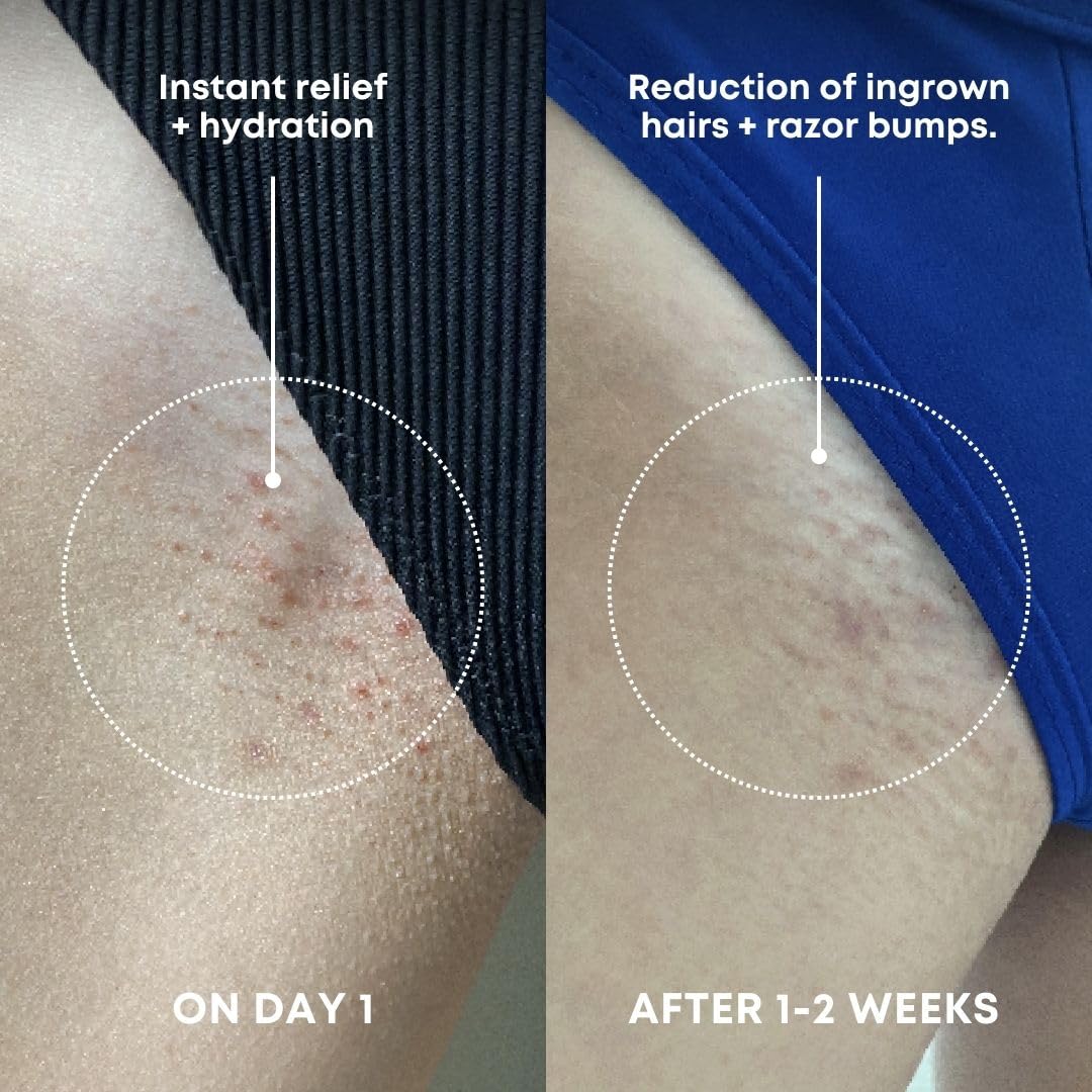 Bushbalm Ingrown Hair Exfoliating Scrub - Reduces Appearance of Ingrown Hairs and Razor Bumps, Soothes Skin and Post-Shave Redness - Nude, 236 ml - Available at All In One Marketplace Canada