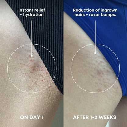 Bushbalm Ingrown Hair Exfoliating Scrub - Reduces Appearance of Ingrown Hairs and Razor Bumps, Soothes Skin and Post-Shave Redness - Nude, 236 ml - Available at All In One Marketplace Canada
