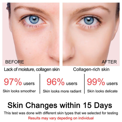 Collagen Jelly Cream - Contains Niacinamide & Freeze Dried Hydrolyzed Collagen -Elasticity & Hydration - Reduce Fine Lines & Dullness - Korean Glass-Shiny Skin Suitable for All Skin Types (3.38 Fl.Oz) - Available at All In One Marketplace Canada