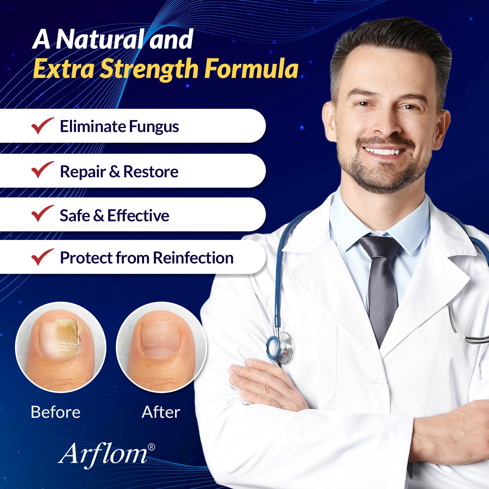 Arflom Toenail Fungus Treatment : 25% Undecylenic Fungal Nail Treatment Extra Strength - Toe and Fingernail with Tea Tree Oil (2pcs, 15ml each) - Available at All In One Marketplace Canada