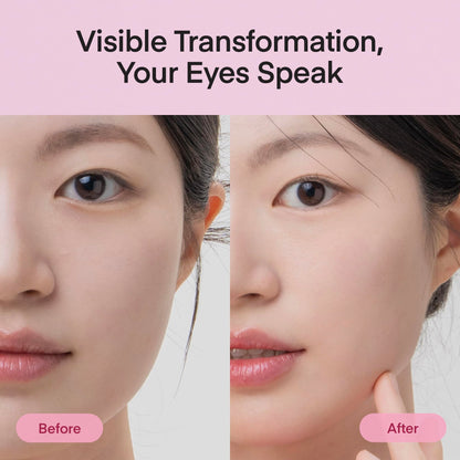 Under Eye Patches Korean Skincare: Peptide Collagen Gel Eye Mask for Puffy Eyes Dark Circles Wrinkles Undereye Bags Fine Lines & Smile Lines - Deep Hydrating & Firming Eye Pad - Cruelty-Free, 30 Pairs - Available at All In One Marketplace Canada