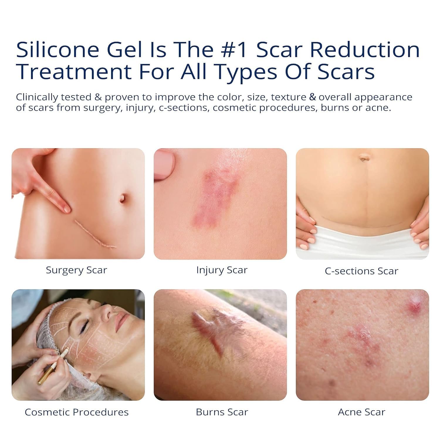 100% Silicone Scar Gel Scar Cream - Advanced Scar Gel for Old and New Scars - Available at All In One Marketplace Canada